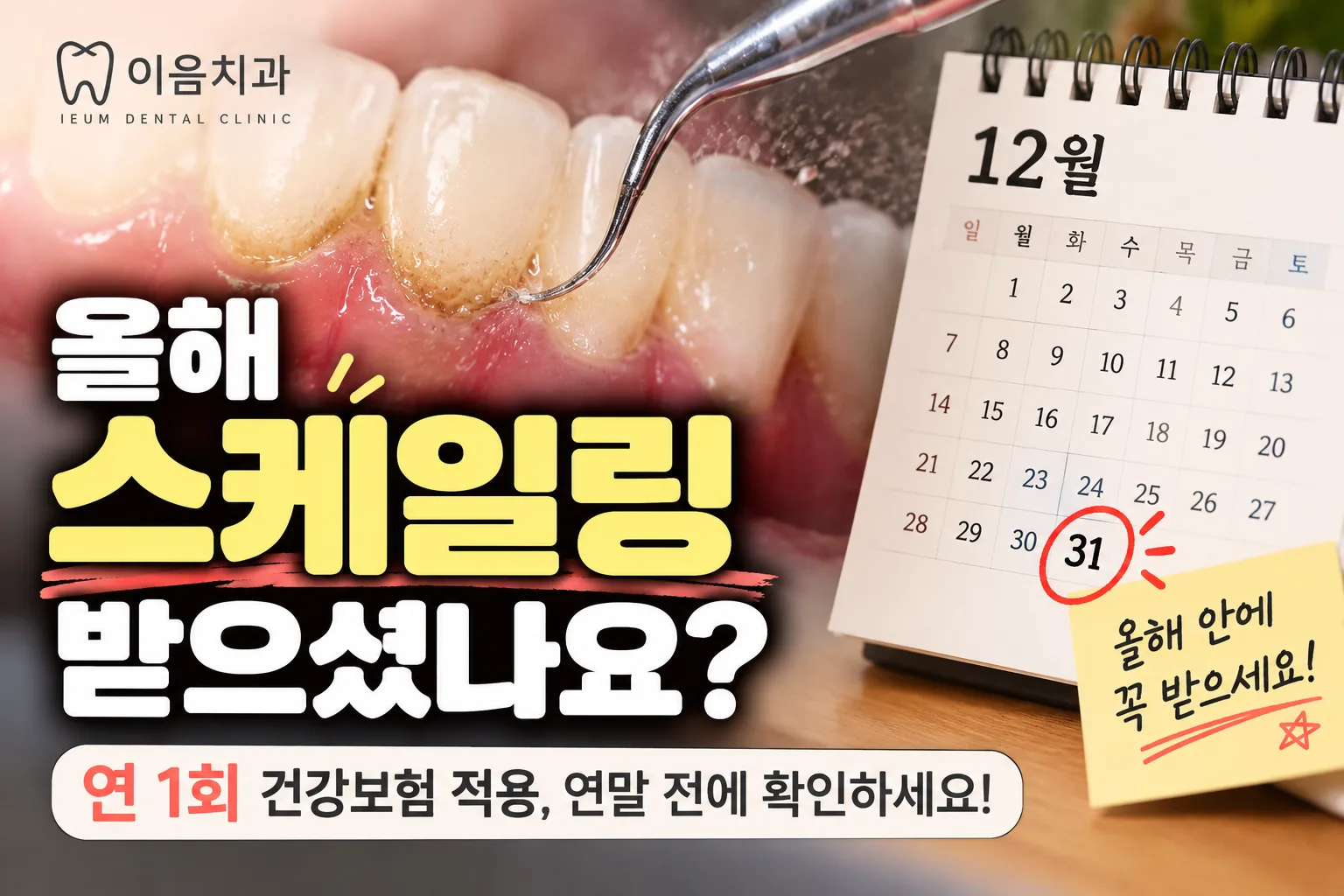 [부산 명지 치과] 스케일링 건강보험 연 1회, 2026년이 지나기 전에 확인하세요